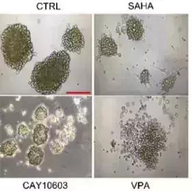 Neurospheres under HDACi therapy
